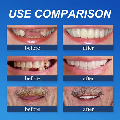 🌎Ends Today: 70% OFF! ⏰Qelavo™ Medical Full Denture with Strong Suctiond🦷Manufactured in FDA-registered facilities