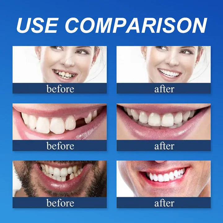 🌎Ends Today: 70% OFF! ⏰Qelavo™ Medical Full Denture with Strong Suctiond🦷Manufactured in FDA-registered facilities