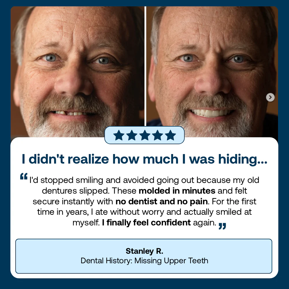 🌎Ends Today: 70% OFF! ⏰Qelavo™ Medical Full Denture with Strong Suctiond🦷Manufactured in FDA-registered facilities